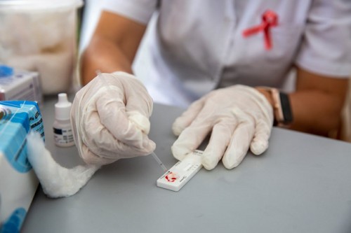 Día Nacional de Respuesta al VIH-SIDA: aumentó el testeo y se mantuvo la mortalidad